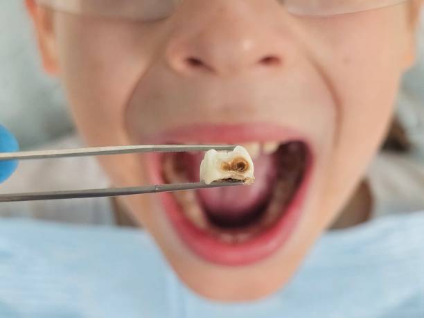Best Urgent Dental Care for Toothaches in Chalfant, CA